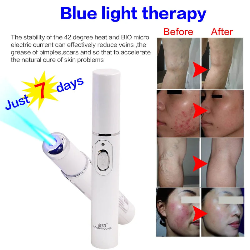 Facial Acne Wrinkle Removal Pen