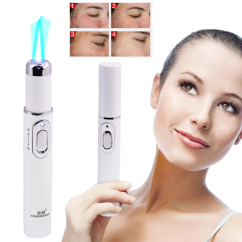 Facial Acne Wrinkle Removal Pen