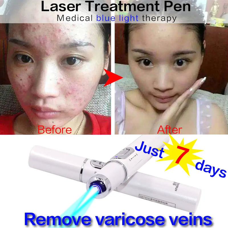 Facial Acne Wrinkle Removal Pen