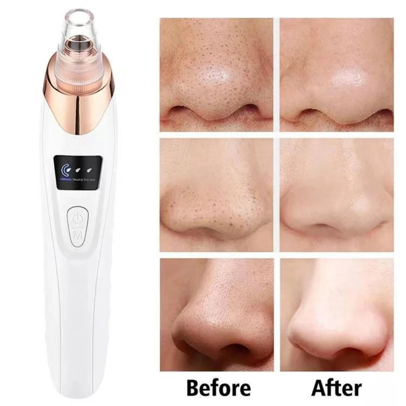 Facial Blackhead Remover Vacuum