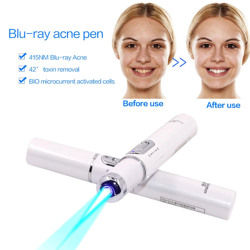 Facial Acne Wrinkle Removal Pen