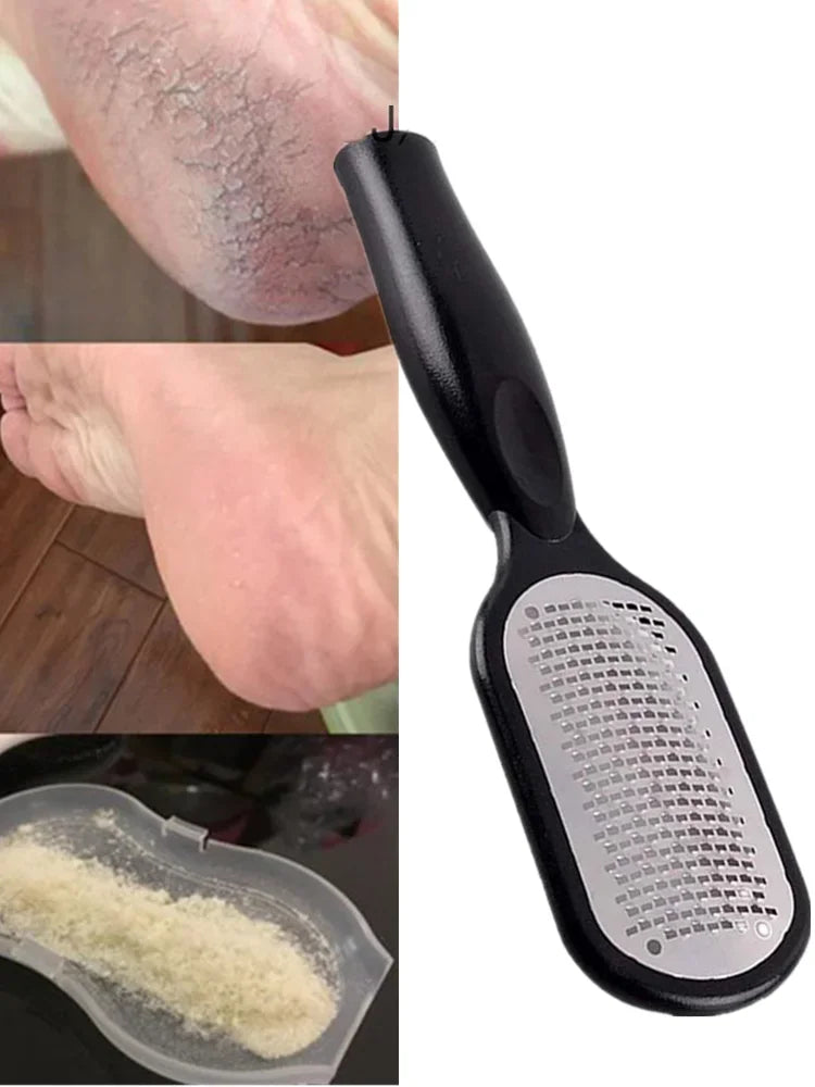 Professional Callus Remover